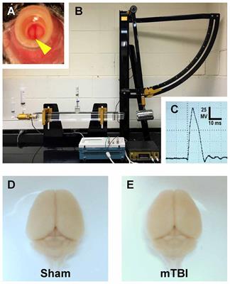 Mild Traumatic Brain Injury Evokes Pyramidal Neuron Axon Initial Segment Plasticity and Diffuse Presynaptic Inhibitory Terminal Loss